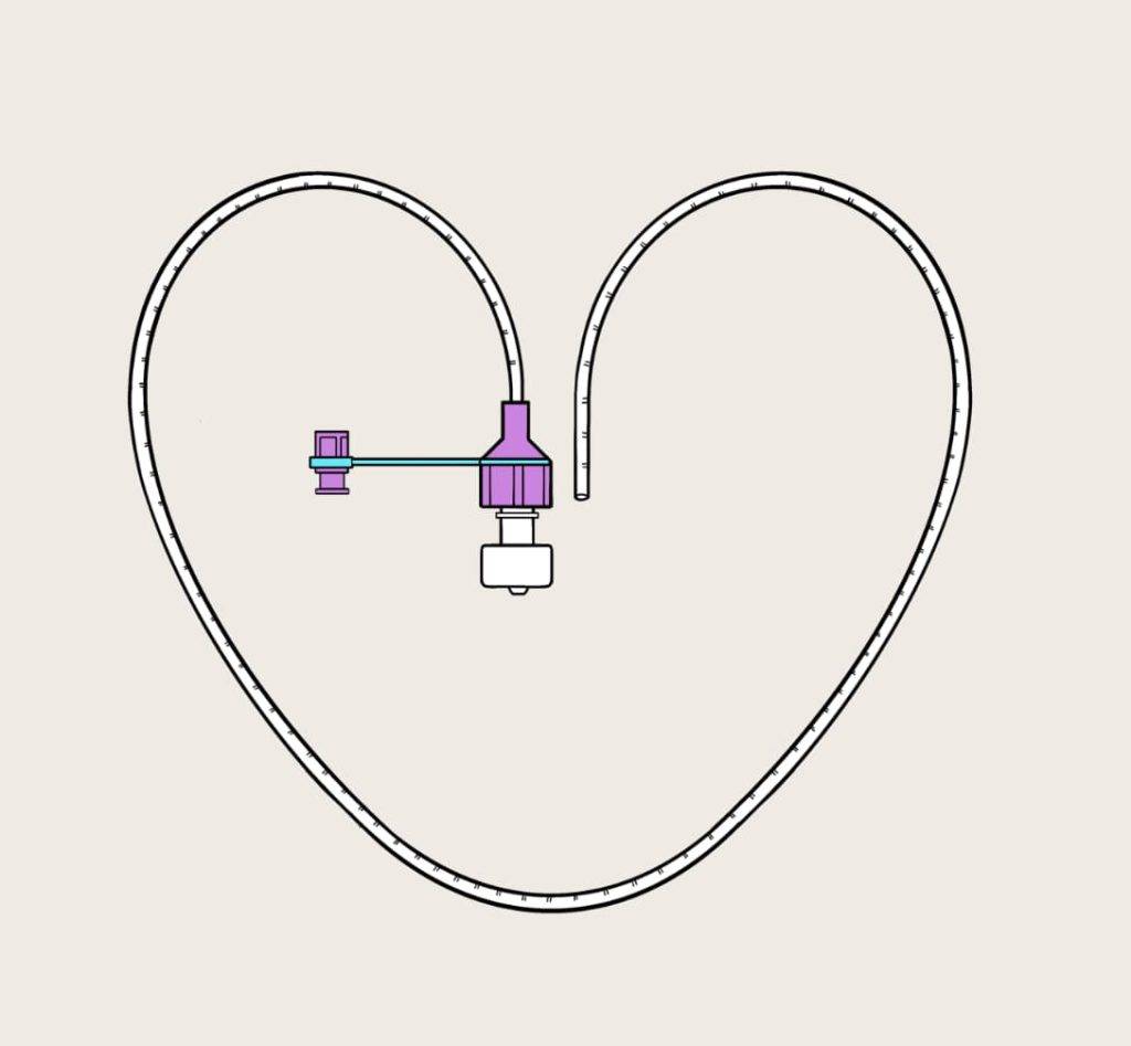 Image of a feeding tube shaped into a heart